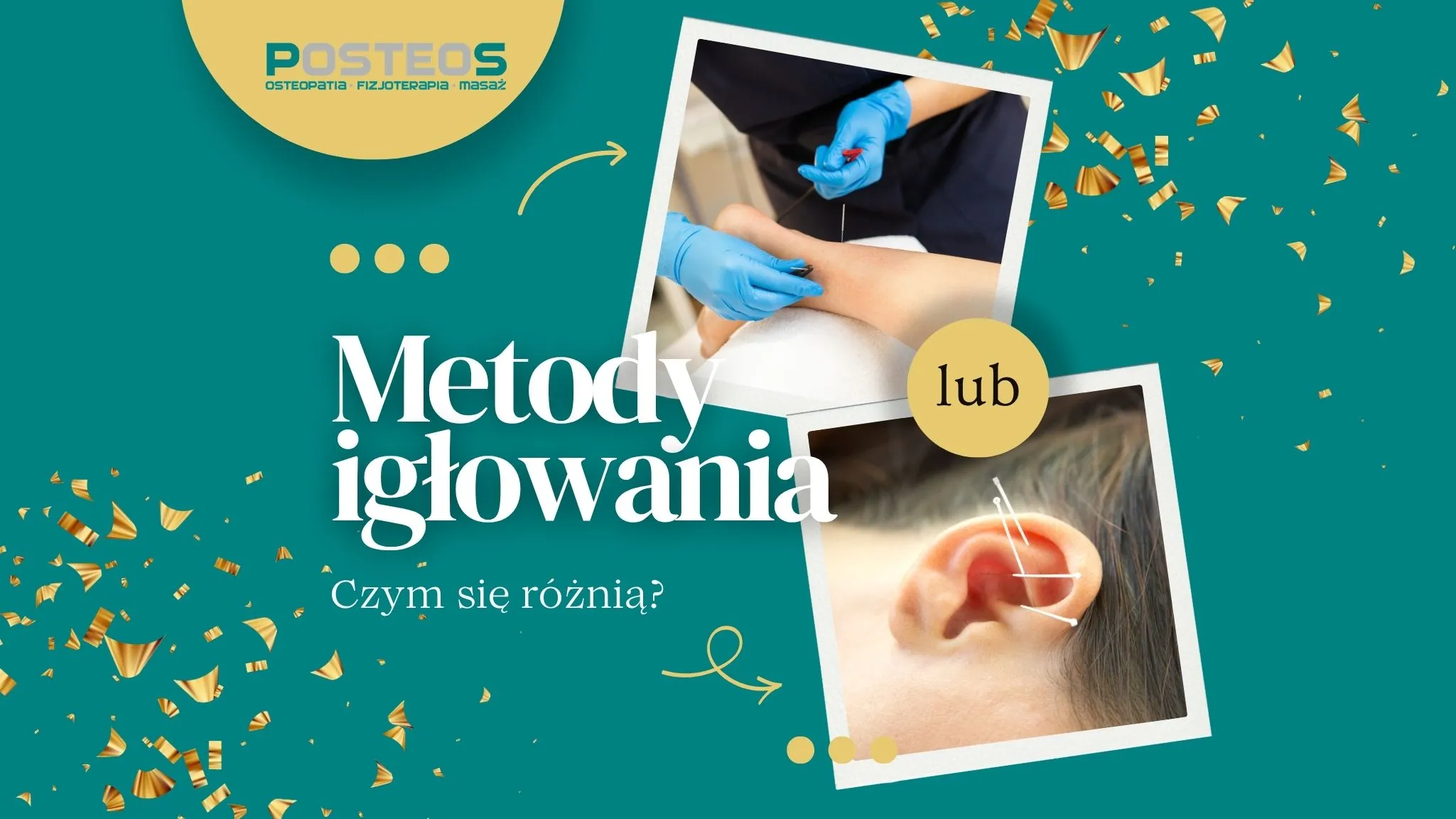 Suche Igłowanie (Dry Needling) vs. Akupunktura w Lidzbarku Warmińskim: Która Metoda Igłowania Jest Dla Ciebie?